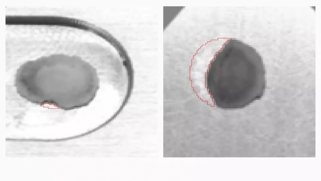 振子蘑菇頭的缺陷(圖4) 振子蘑菇頭的缺陷(圖4)